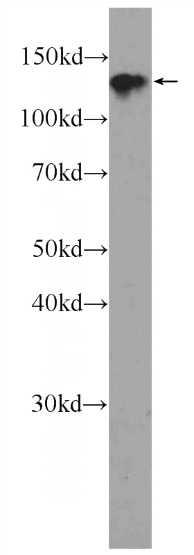NIH/3T3 cells were subjected to SDS PAGE followed by western blot with Catalog No:109815(CYTSA Antibody) at dilution of 1:600