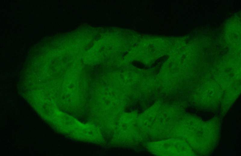Immunofluorescent analysis of (10% Formaldehyde) fixed A549 cells using Catalog No:111828(IRAK1 Antibody) at dilution of 1:50 and Alexa Fluor 488-congugated AffiniPure Goat Anti-Rabbit IgG(H+L)