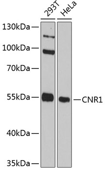 Western blot - CNR1 Polyclonal Antibody 