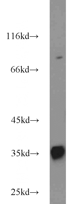 HepG2 cells were subjected to SDS PAGE followed by western blot with Catalog No:109080(CCS antibody) at dilution of 1:1000