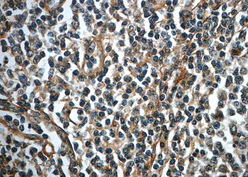Immunohistochemistry of paraffin-embedded human tonsillitis slide using Catalog No:111857(ITGA1 Antibody) at dilution of 1:50 (under 40x lens)