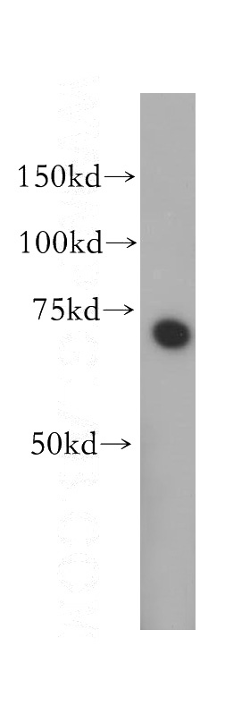 mouse heart tissue were subjected to SDS PAGE followed by western blot with Catalog No:107817(ABI2 antibody) at dilution of 1:400