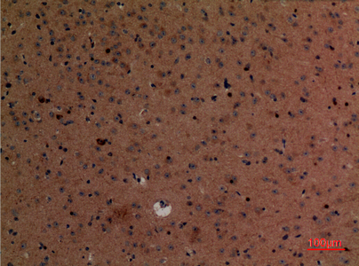 Fig2:; Immunohistochemical analysis of paraffin-embedded mouse-brain, antibody was diluted at 1:100