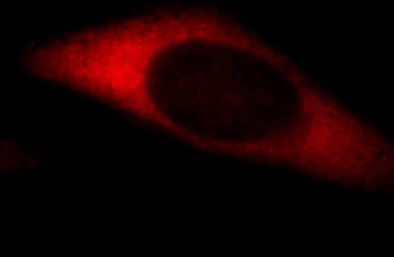 Immunofluorescent analysis of HepG2 cells, using DIAPH1 antibody Catalog No:109937 at 1:25 dilution and Rhodamine-labeled goat anti-rabbit IgG (red).