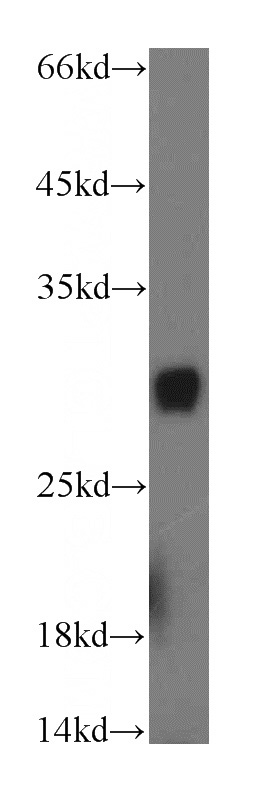 mouse brain tissue were subjected to SDS PAGE followed by western blot with Catalog No:113473(PAAF1 antibody) at dilution of 1:2000