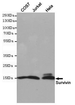 Western blot detection of Survivin in COS7,Jurkat and Hela cell lysates using Survivin mouse mAb (1:1000 diluted).Predicted band size:16kDa.Observed band size:16kDa.