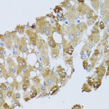 Immunohistochemistry - BNIP3 Polyclonal Antibody 