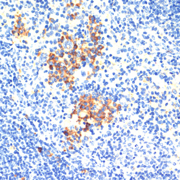 Immunohistochemistry - THBS1 Polyclonal Antibody 