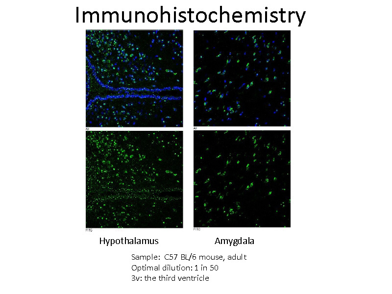 IF result of anti-GPR50 (Catalog No:111130, 1:50) with mouse brain tissue slide by Dr. Qian Li, University of Edinburgh.