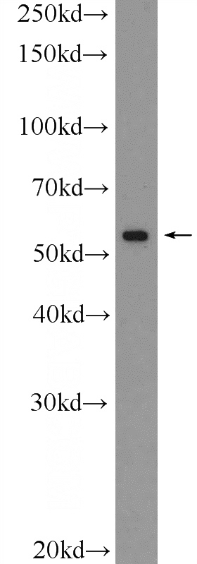 PC-3 cells were subjected to SDS PAGE followed by western blot with Catalog No:116734(VDR Antibody) at dilution of 1:1000