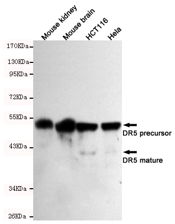 Western blot detection of DR5 in Mouse kindey,Mouse brain,HCT116 and Hela cell lysates using DR5 mouse mAb (1:500-1:2000 diluted).Predicted band size:40/48KDa.Observed band size:40/48KDa.