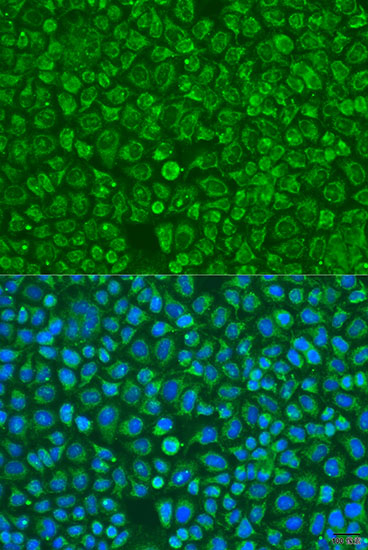 Immunofluorescence - ARSF Polyclonal Antibody 