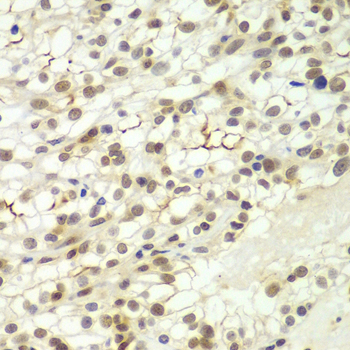 Immunohistochemistry - LHX4 Polyclonal Antibody 