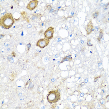 Immunohistochemistry - MGP Polyclonal Antibody 