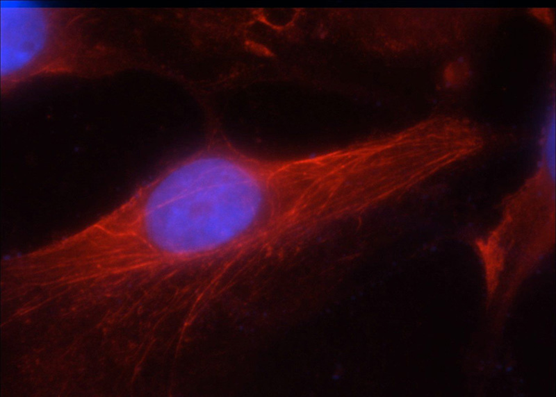 Immunofluorescent analysis of HeLa cells using Catalog No:111894(JNK2 Antibody) at dilution of 1:25 and Rhodamine-Goat anti-Rabbit IgG