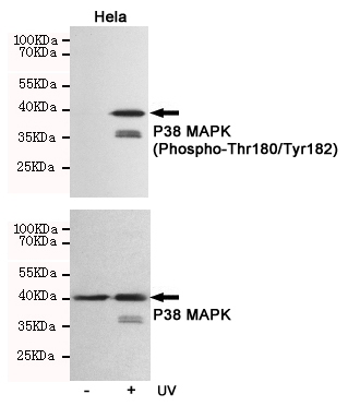 Western blot analysis of extracts from Hela cells, untreated or treated with UV, using P38 MAPK(Phospho-Thr180/Tyr182) Rabbit pAb (166717,1:500 diluted,upper) or p38 MAPK Rabbit pAb (310008,1:500 diluted,lower).