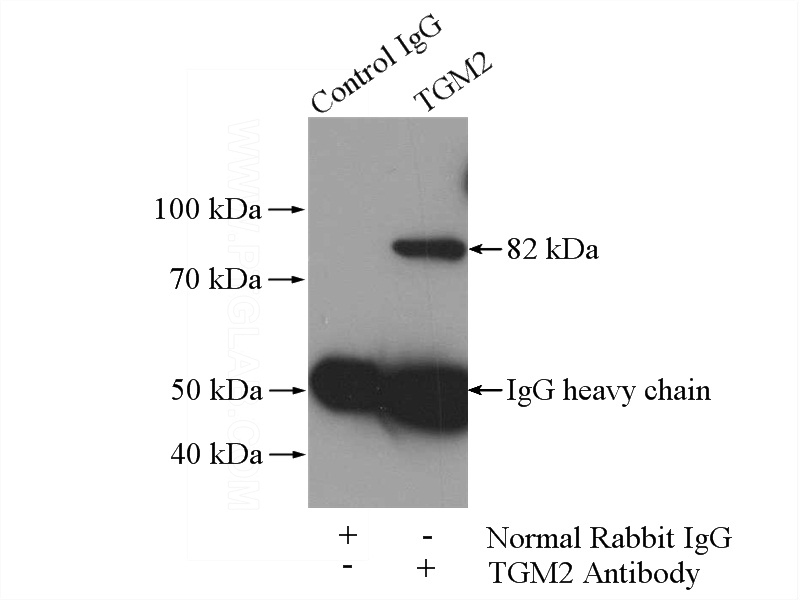 IP Result of anti-TGM2 (IP:Catalog No:116029, 4ug; Detection:Catalog No:116029 1:400) with HeLa cells lysate 1200ug.