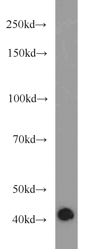HeLa cells were subjected to SDS PAGE followed by western blot with Catalog No:110148(DAG1 antibody) at dilution of 1:500