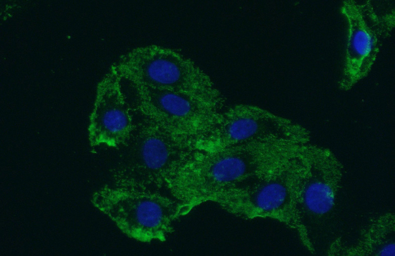 Immunofluorescent analysis of (-20oc Acetone) fixed SH-SY5Y cells using Catalog No:108187(FLJ10357 Antibody) at dilution of 1:50 and Alexa Fluor 488-congugated AffiniPure Goat Anti-Rabbit IgG(H+L)