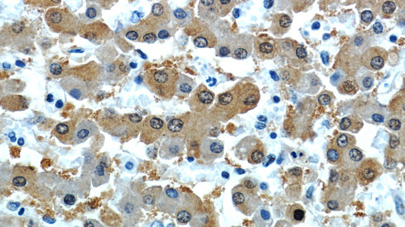 Immunohistochemistry of paraffin-embedded human liver slide using Catalog No:114638(RGN,SMP30 Antibody) at dilution of 1:50