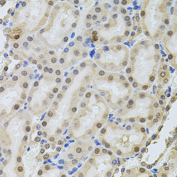 Immunohistochemistry - POP4 Polyclonal Antibody 