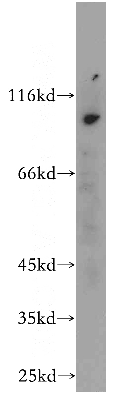 mouse lung tissue were subjected to SDS PAGE followed by western blot with Catalog No:109649(CXorf22 antibody) at dilution of 1:500