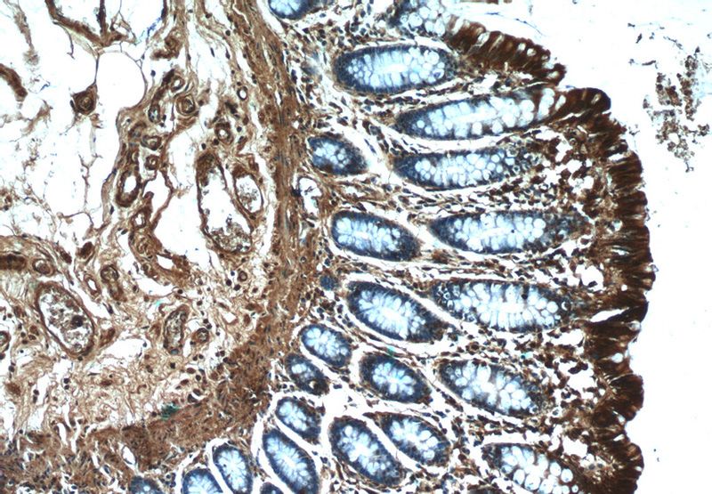 Immunohistochemistry of paraffin-embedded human colon tissue slide using Catalog No:114723(RMND5B Antibody) at dilution of 1:50 (under 10x lens)