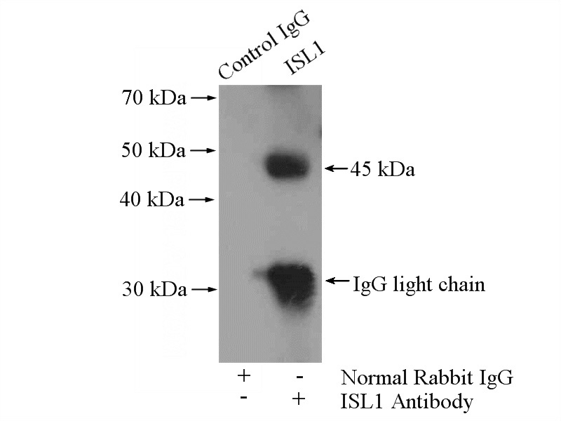 IP Result of anti-Islet 1 (IP:Catalog No:111941, 4ug; Detection:Catalog No:111941 1:500) with HeLa cells lysate 2000ug.