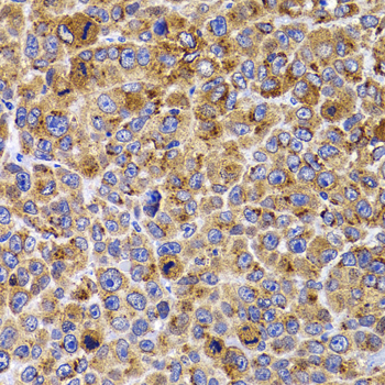 Immunohistochemistry - UBE2R2 Polyclonal Antibody 