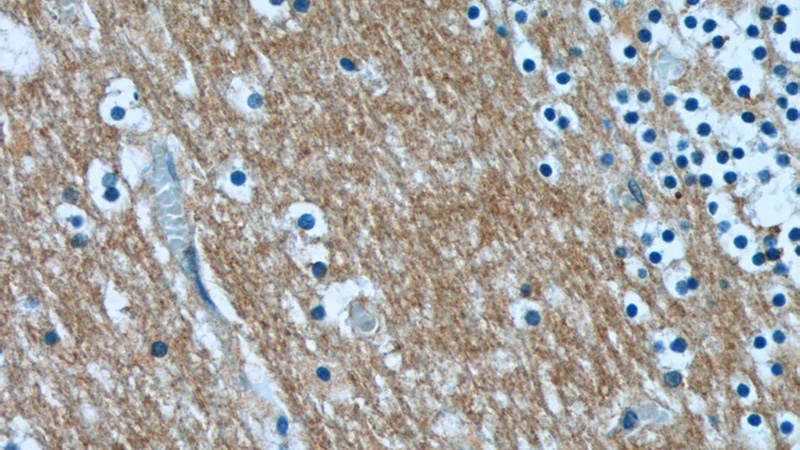 Immunohistochemistry of paraffin-embedded human cerebellum tissue slide using Catalog No:108082(ANKRD57 Antibody) at dilution of 1:50 (under 40x lens)