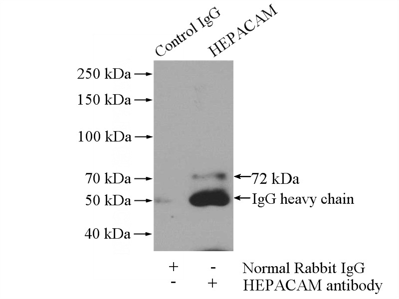IP Result of anti-HEPACAM (IP:Catalog No:111291, 4ug; Detection:Catalog No:111291 1:500) with rat brain tissue lysate 4000ug.