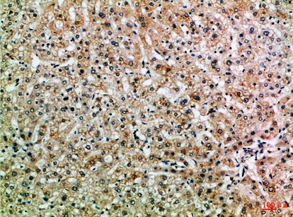 Fig1:; Immunohistochemical analysis of paraffin-embedded Human-liver, antibody was diluted at 1:100