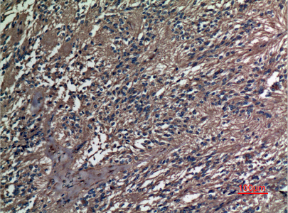 Immunohistochemical analysis of paraffin-embedded human-ovary, antibody was diluted at 1:100