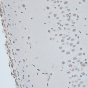Immunohistochemistry - ZNF433 Polyclonal Antibody 