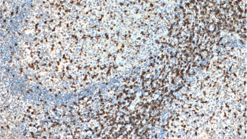 Immunohistochemistry of paraffin-embedded human tonsillitis tissue slide using Catalog No:109019(CD3D Antibody) at dilution of 1:200 (under 10x lens). heat mediated antigen retrieved with Tris-EDTA buffer(pH9).