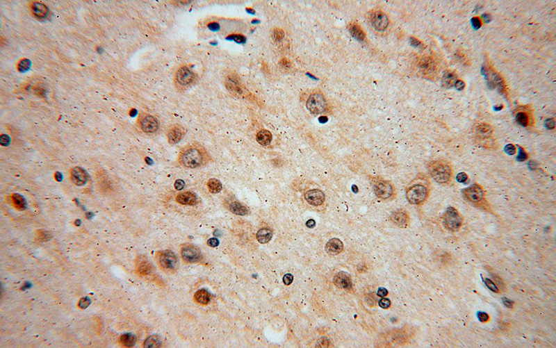 Immunohistochemical of paraffin-embedded human brain using Catalog No:109886(DEK antibody) at dilution of 1:100 (under 40x lens)