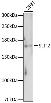 Western blot - SLIT2 Polyclonal Antibody 