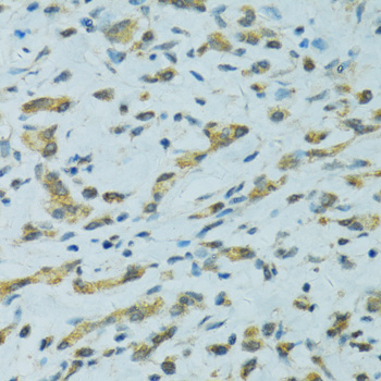 Immunohistochemistry - CYP2B6 Polyclonal Antibody 