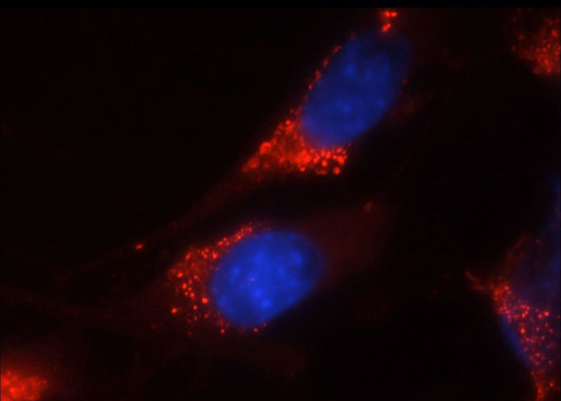 Immunofluorescent analysis of NIH/3T3 cells using Catalog No:107133(CD38 Antibody) at dilution of 1:25 and Rhodamine-Goat anti-Mouse IgG
