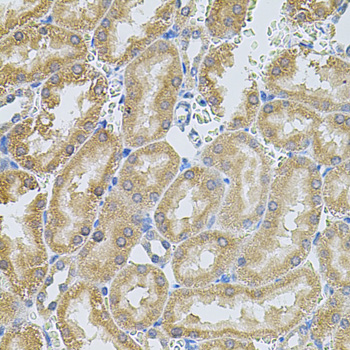 Immunohistochemistry - MMP10 Polyclonal Antibody 