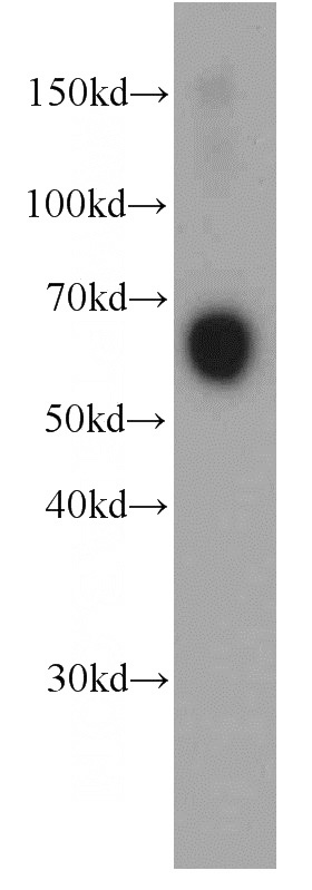 human blood tissue were subjected to SDS PAGE followed by western blot with Catalog No:107574(SERPINA3,AACT antibody) at dilution of 1:1000