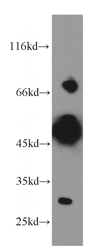 mouse brain tissue were subjected to SDS PAGE followed by western blot with Catalog No:114691(REPS2 antibody) at dilution of 1:300