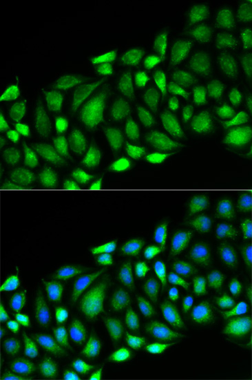 Immunofluorescence - RIPK2 Polyclonal Antibody 