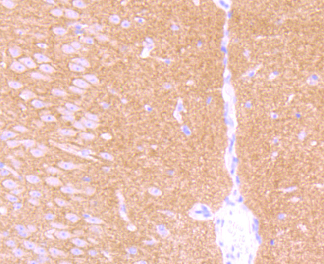 Fig2: Immunohistochemical analysis of paraffin-embedded mouse brain tissue using anti- GABA B Receptor 2 antibody. Counter stained with hematoxylin.