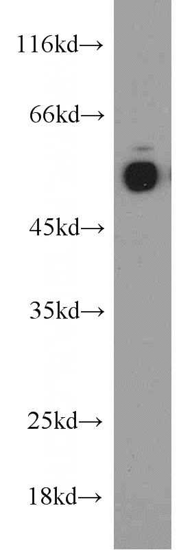rat brain tissue were subjected to SDS PAGE followed by western blot with Catalog No:111800(INHBA-Specific antibody) at dilution of 1:300
