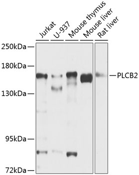 Western blot - PLCB2 Polyclonal Antibody 