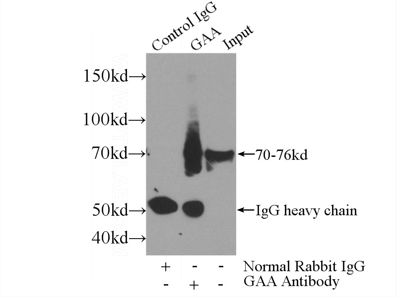 IP Result of anti-GAA (IP:Catalog No:110767, 4ug; Detection:Catalog No:110767 1:600) with mouse liver tissue lysate 4000ug.