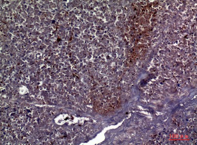 Fig2:; Immunohistochemical analysis of paraffin-embedded human-pancreas, antibody was diluted at 1:100