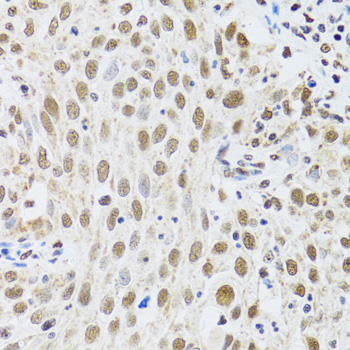 Immunohistochemistry - MTA3 Polyclonal Antibody 