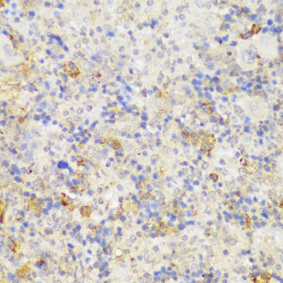 Immunohistochemistry - GCC2 Polyclonal Antibody 